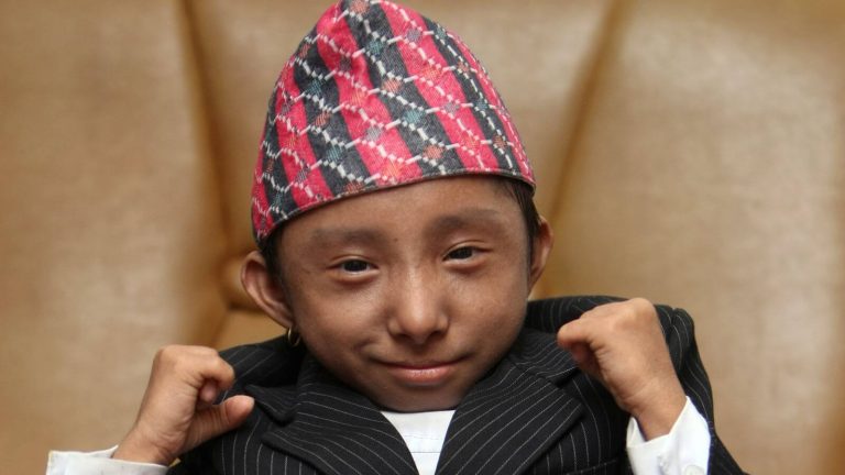 Who Has the Smallest Head in The World?