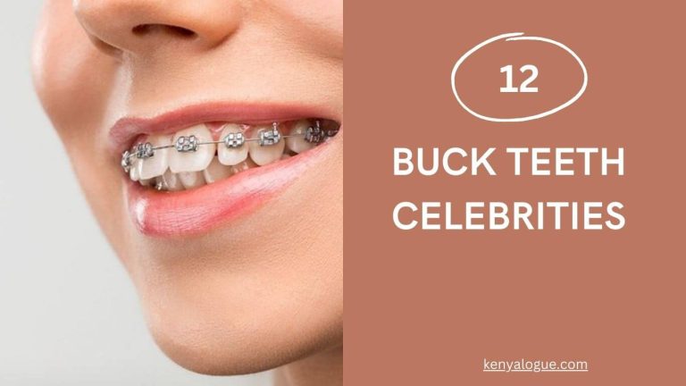 Top 12 Buck Teeth Celebrities